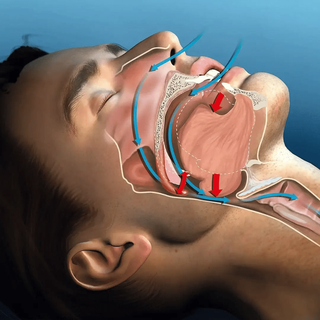 SilentSeal™ - MyMula