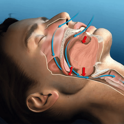 SilentSeal™ - MyMula